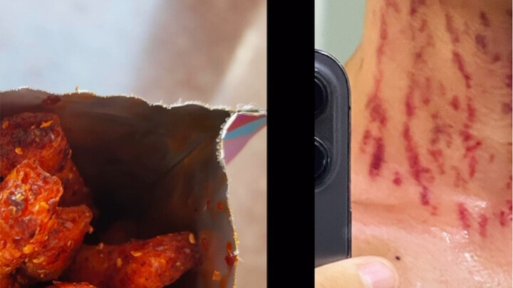 After you ate the devil-level spicy strips... you turned into Uchiha's neck!