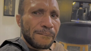 部落人在中国看病