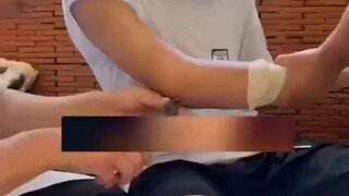 Beginilah cara jarum baja yang digunakan dalam operasi fraktur dilepas. "Anda tidak akan pernah melu