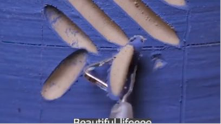 sống vui sống khỏe p4 #mytivi