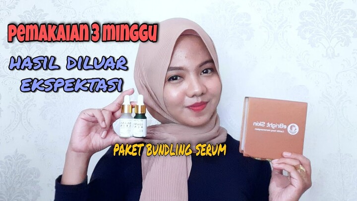 HONEST REVIEW PAKET BUNDLING SERUM EBRIGHT SKIN | glass skin essence + breakout control acne serum