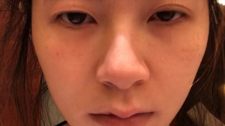 หนุ่มสาวที่นอนดึกจนเป็นอัมพาตใบหน้ากำลังมีจำนวนเพิ่มขึ้นเรื่อยๆ