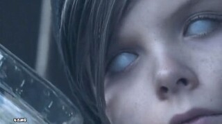 天生拥有一双白色眼球的男孩，没想到接下来的一幕惊呆了