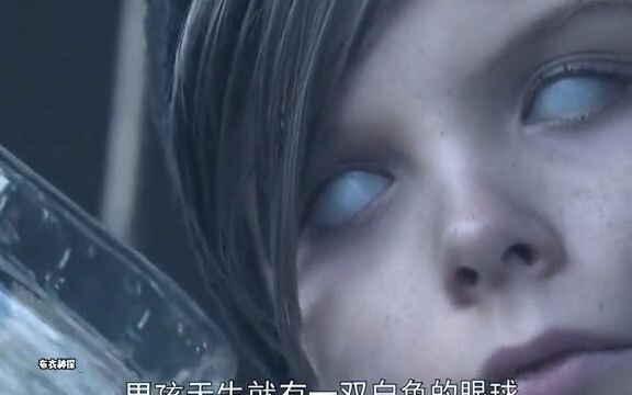 天生拥有一双白色眼球的男孩，没想到接下来的一幕惊呆了