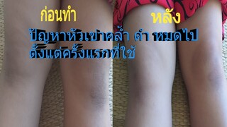 ผิวบริเวณหัวเข่าที่เคยคล้ำ ดำ จะขาวขึ้นได้ด้วยวิธีนี้ ราคาก็ประหยัดแต่ได้ผลชัวๆๆ/โดยฮอยไทยอีสาน