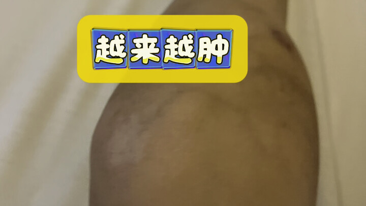 【Xiao Huang Won’t Fall】The creator is exploring—welcome to watch and don’t forget to like, comment, 