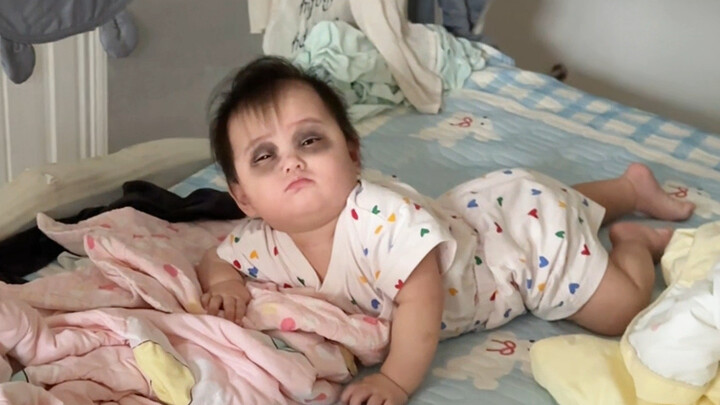Every child who loves to stay up late should be punished with dark circles under the eyes!