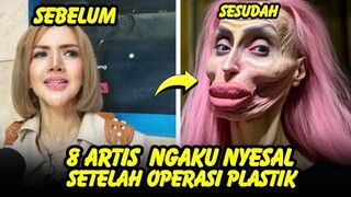 GAGAL CANTIK, 8 artis ini mengaku menyesal setelah Lakukan operasi plastik