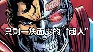 超人终于登场！但却是浑身无一血肉，只剩冰冷机械的“超人”