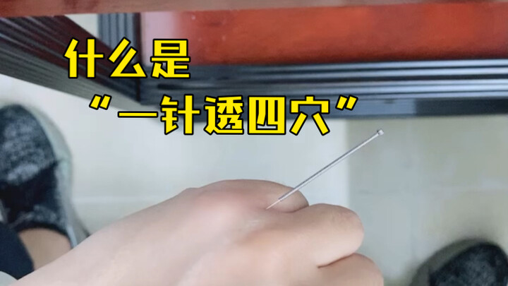 การฝังเข็มแบบทะลุ รู้สึกค่อนข้างดี