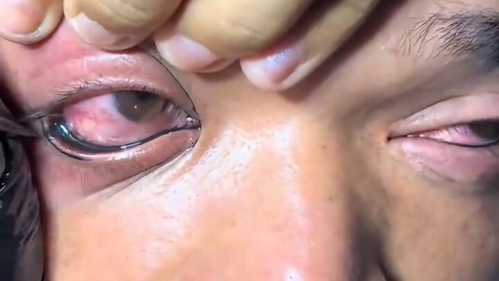 [Homo Sapiens TV] Too lazy to draw eyeliner, so I just got my eyes tattooed