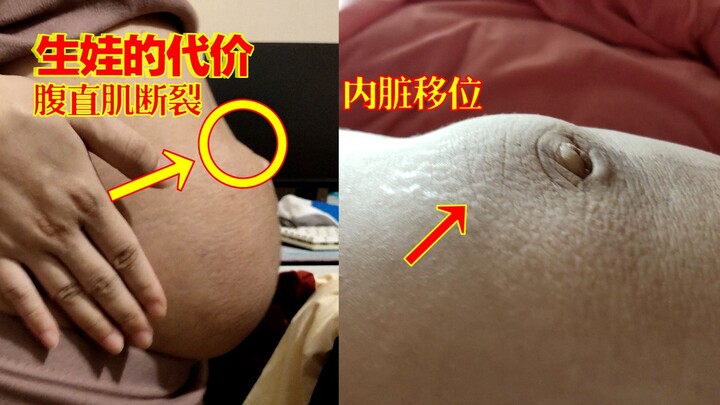 胆小勿看！刚生完宝宝到产后20天身体变化！