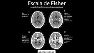 Parámetros de las patologías cerebrales