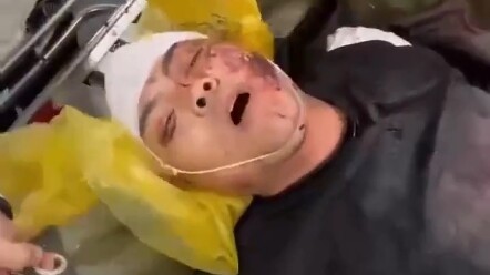 Toàn thân mềm nhũn hết rồi, chỉ còn cái miệng là cứng thôi.