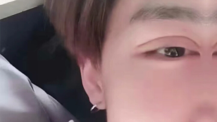 تغيّر أسلوبه بالكامل بعد أن أجرى عملية جراحة الجفن المزدوج!