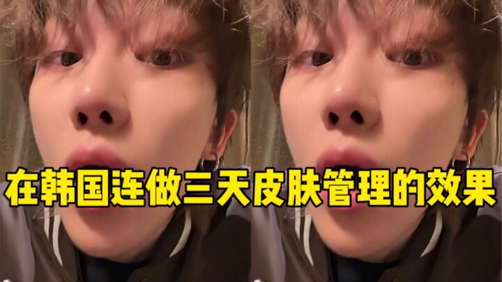 ซูหมิงหาว “ก่อนไปชมแฟชั่นโชว์ของ LV ทำทรีตเมนต์ผิวมาสามวันติด” / งั้นเล่าให้ฟังละเอียดหน่อยสิ ฮ่าๆๆ