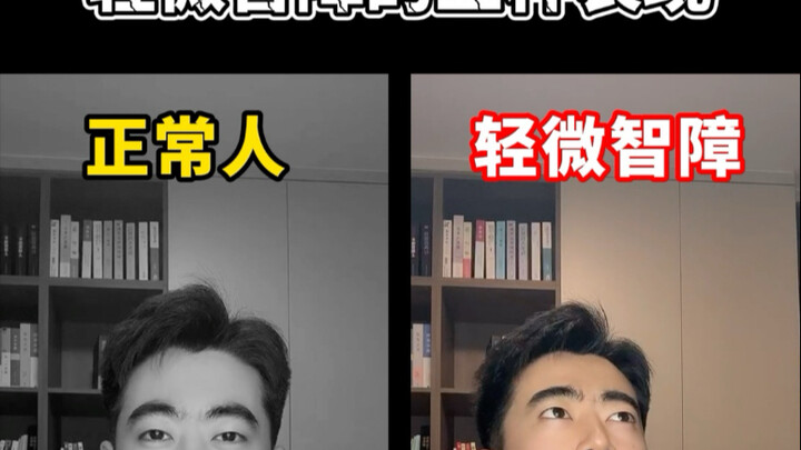 อาการของคนที่มีความบกพร่องทางสติปัญญาเล็กน้อย มีหลายแบบ ลองดูว่าคนรอบตัวคุณเป็นแบบนี้ไหม? ถ้ามีเพิ่ม