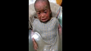 في عام 2019، كانت جلسات العلاج في ذلك الوقت مروعة وموجعة للغاية كل يوم، ولا أعرف كيف استطعت الصمود.