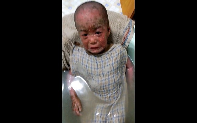 Pada tahun 2019, setiap hari perawatannya begitu dahsyat dan menyayat hati, entah bagaimana saya bis