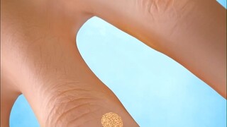 ทำไมหูดที่ขึ้นบนผิวหนังถึงไม่สามารถตัดออกได้เลยล่ะ?