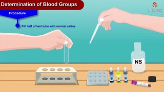 Determination of blood groups animation - #usmle Physiology practicals