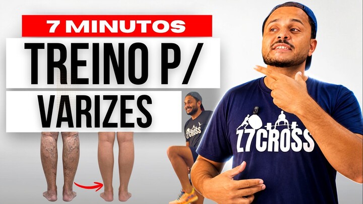 Alívio para varizes em casa: 7 minutos por dia para pernas leves!