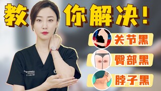 Khớp đen, mông đen, cổ đen, bác sĩ da liễu chỉ bạn cách xử lý!