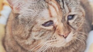 عدساتي اللاصقة تنزلق