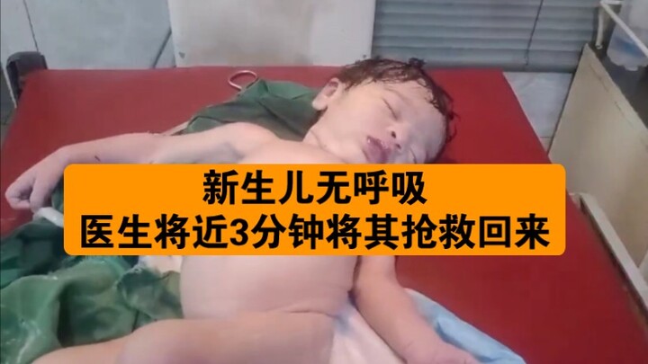 توقف الطفل حديث الولادة عن التنفس وبذل الطبيب جهدا كبيرا لإنقاذه من الموت!