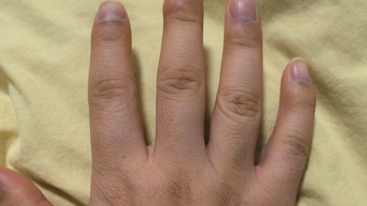 Do we even need to analyze this move? It’s obviously a no-brainer.