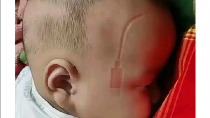 Getting cybernetic implants at such a young age—this kid’s bound to become a legend in Night City.