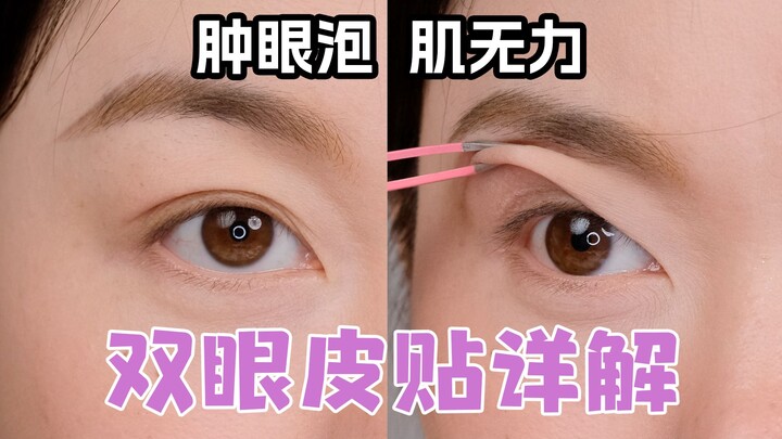 Nếu bạn dán mí đôi đến chết cũng không đẹp, phiên bản khó nhằn cho mí sưng và mí lót