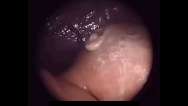 Real Video of a Baby Inside the Mother’s Womb Amazing, right?