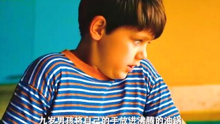 九岁男孩将手放进沸腾的油锅，只为享受疼痛带来的快感