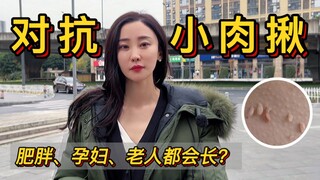 Vậy thì cổ xuất hiện những cục thịt nhỏ là do đâu vậy?