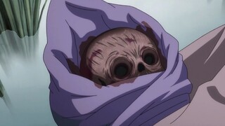 The baby's father sold all his organs, leaving him without eyes, ears, limbs or skin. "Dororo"