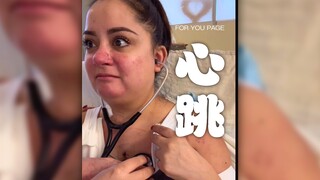 Trước ca phẫu thuật cấy ghép, lần cuối cùng tôi lắng nghe nhịp tim của mình‼️ Sau ca phẫu thuật cấy 