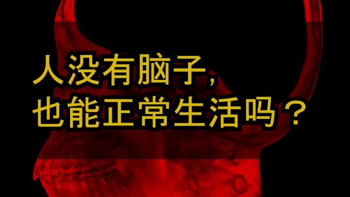 [Shocking] Can People Really Live a Normal Life Without Brains? [Gray Matter]