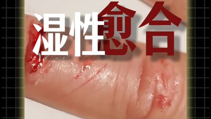 Vết thương đóng vảy thực ra lại lành chậm nhất!