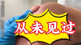 The calluses on the soles of the feet are ridiculously thick. At first glance, I thought it was a pl