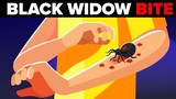 Black Widow Spider Bites - How Painful is it (What Actually Happens to Your Body)?