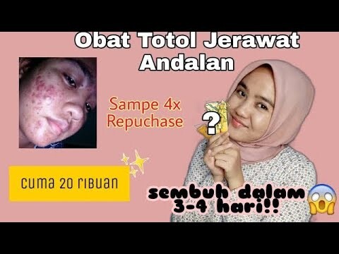 OBAT TOTOL JERAWAT TERBAIK YANG AKU PAKE SELAMA INI DARI TAHUN 2020 ✨
