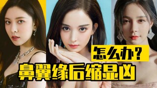 ماذا تفعل إذا كانت حواف الأنف منكمشة للخلف وتبدو قاسية؟