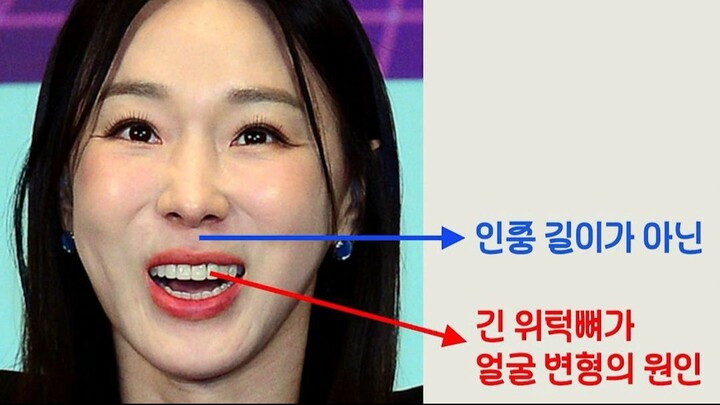 在花费 500 万韩元进行高价手术前，值得考虑的选择 为什么海云台牙科矫正建议先尝试牙齿矫正？