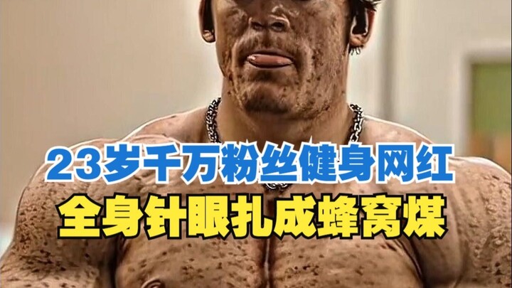 เน็ตไอดอลฟิตเนสวัย 23 ที่มีแฟนคลับนับสิบล้านถูกแทงจนเป็นรูพรุน เต็มไปด้วยรอยเข็ม แผลพุพอง และเนื้อเน