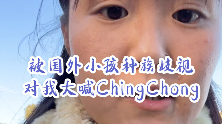 How I Handled Racial Discrimination from a Foreign Kid