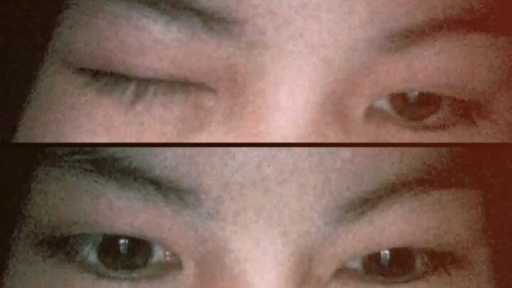 my ayes is normal like you