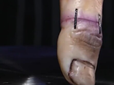 Akhirnya menemukan satu ide yang agak menarik