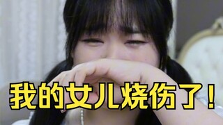 我的女儿被烧伤了，请求大家帮帮我们