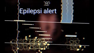 di jaga matanya !!! epilepsi alert !!!